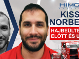 Kiss Norbert (Kamionversenyző) Hajbeültetése -...