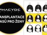 Transplantace vlasu pro zeny - PHAEYDE Clinic...