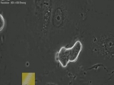 Indukált pluripotens őssejtek kialakulása videón