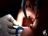 Brill Dental - esztétikai fogászat...