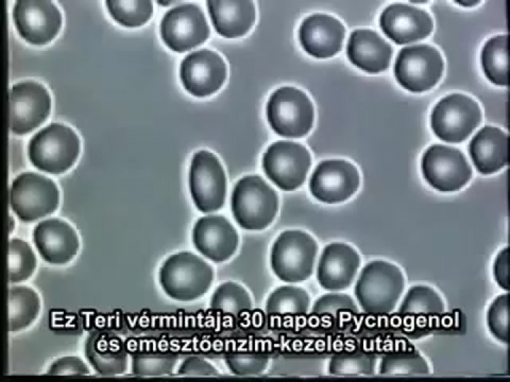 pycnogenol