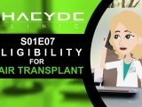 Eligibility for Hair Transplant - PHAEYDE...