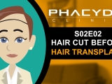 Hair Cut Before Hair Transplant - PHAEYDE...
