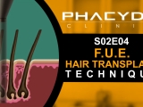 F.U.E. Hair Transplant Technique - PHAEYDE...