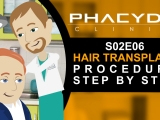 Hair Transplant Procedure Step by Step -...