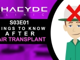 Things To Know After Hair Transplant - PHAEYDE...