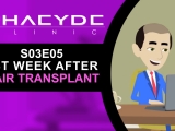 First Week After Hair Transplant - PHAEYDE...