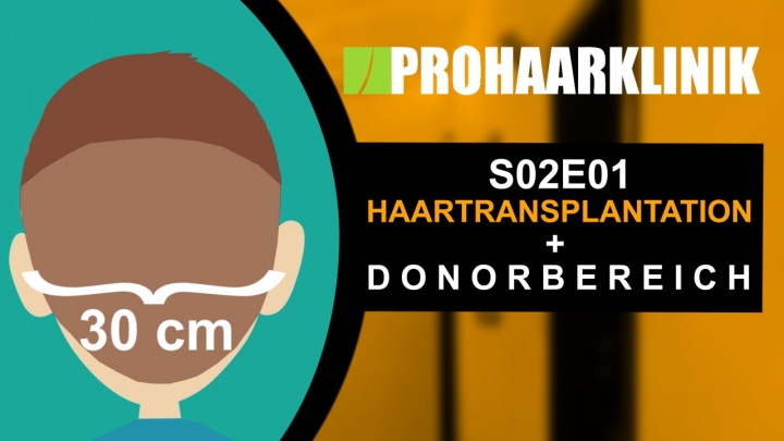 Die Haartransplantation und der Donorbereich - PORHAARKLINIK (S02E01)