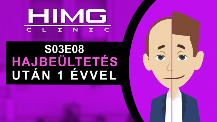 Hajbeültetés után 1 évvel - HIMG Klinika (S03E08 - Évadzáró)