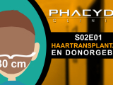 Haartransplantatie en donorgebied - PHAEYDE...