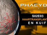 Haartransplantatie en Kuif - PHAEYDE Kliniek...