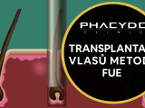 Transplantace Vlasu Metoda FUE - PHAEYDE...