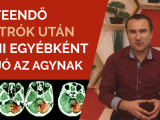 8 teendő Stroke után, ami egyébként is jó az...