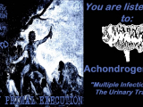 Achondrogenesis - 3 tracks recovered from 3...