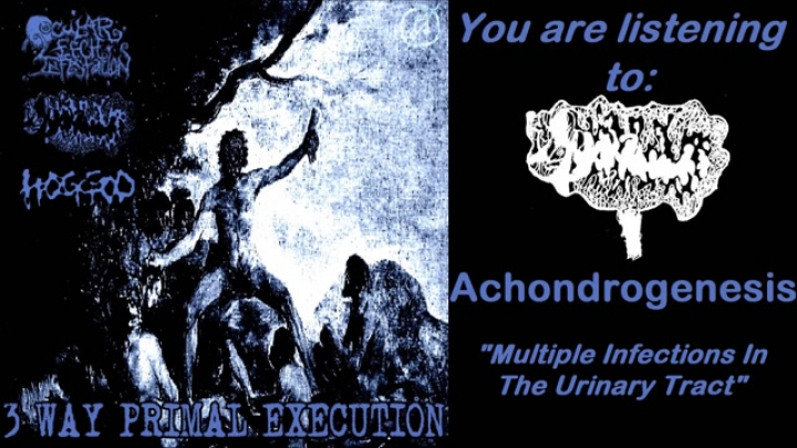Achondrogenesis - 3 tracks recovered from 3 Way Primal Execution (2020 - Goregrind)